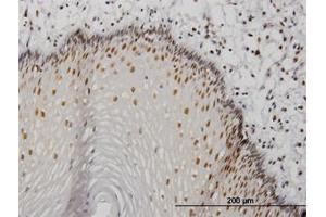 Image no. 3 for anti-Metastasis Associated 1 (MTA1) (AA 601-701) antibody (ABIN598597) (MTA1 Antikörper  (AA 601-701))