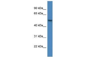 WB Suggested Anti-ARHGAP19 AntibodyTitration: 1. (ARHGAP19 Antikörper  (C-Term))