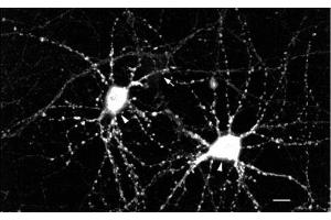 Immunocytochemistry/Immunofluorescence analysis using Mouse Anti-CaMKII Monoclonal Antibody, Clone 22B1 . (CAMKII gamma Antikörper  (Atto 488))