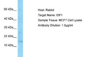 Host: RabbitTarget Name: EIF1Antibody Dilution: 1. (EIF1 Antikörper  (Middle Region))