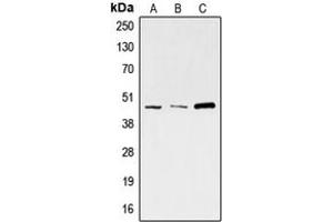 Western blot analysis of SKP2 expression in A673 (A), HeLa (B), K562 (C) whole cell lysates.