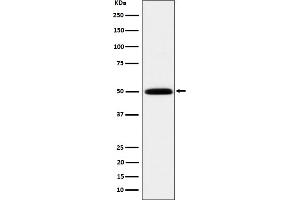Western blot analysis of HARS expression in 293T cell lysate.