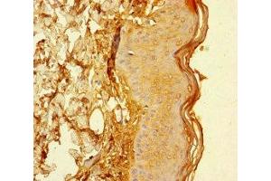 Immunohistochemistry of paraffin-embedded human skin tissue using ABIN7147268 at dilution of 1:100 (CYREN (AA 1-157) Antikörper)