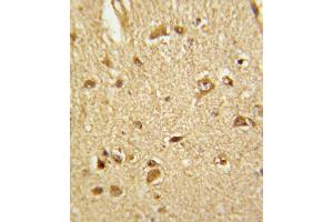 Immunohistochemistry (IHC) image for anti-Cystathionine-beta-Synthase (CBS) antibody (ABIN3002904)