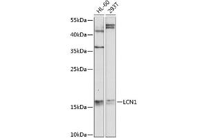 Western blot analysis of extracts of various cell lines, using LCN1 antibody  at 1:1000 dilution. (Lipocalin 1 Antikörper  (AA 19-176))