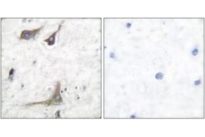 Immunohistochemistry analysis of paraffin-embedded human brain tissue, using Cox1 Antibody. (COX1 Antikörper  (AA 550-599))