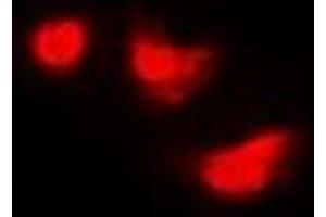 Immunofluorescent analysis of IMPDH2 staining in Hela cells. (IMPDH2 Antikörper)