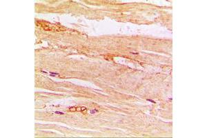 Immunohistochemical analysis of GLUT4 staining in human muscle formalin fixed paraffin embedded tissue section.