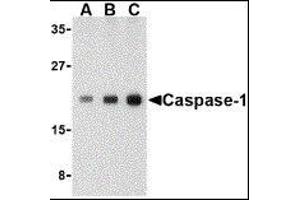 Western Blotting (WB) image for anti-Caspase 1 (CASP1) (C-Term) antibody (ABIN2477902) (Caspase 1 Antikörper  (C-Term))