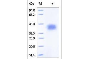 Human TNFR2, His Tag on SDS-PAGE under reducing (R) condition. (TNFRSF1B Protein (AA 23-257) (His tag))