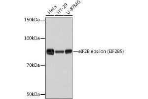 Western blot analysis of extracts of various cell lines, using eIF2B epsilon (EIF2B5) (EIF2B5) Rabbit mAb (ABIN7267038) at 1:1000 dilution. (EIF2B5 Antikörper)