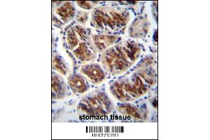Immunohistochemistry (IHC) image for anti-Gap Junction Protein, alpha 4, 37kDa (GJA4) (AA 303-333), (C-Term) antibody (ABIN5536706)