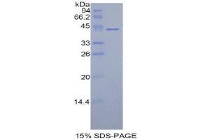 SDS-PAGE (SDS) image for Histone H2A Type 1-C (HIST1H2AC) (AA 2-130) protein (His tag,GST tag) (ABIN1878265)