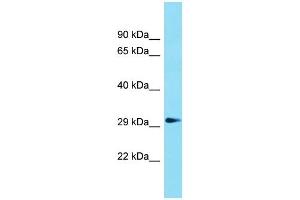 Western Blotting (WB) image for anti-Glycerophosphodiester Phosphodiesterase Domain Containing 1 (GDPD1) (N-Term) antibody (ABIN2791029) (GDPD1 Antikörper  (N-Term))