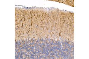 Immunohistochemistry of paraffin-embedded mouse brain using Kallikrein 8 Rabbit mAb (ABIN7268065) at dilution of 1:100 (40x lens). (Kallikrein 8 Antikörper)
