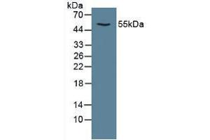 Figure. (CAMK2A Antikörper  (AA 1-478))