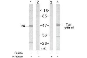 Image no. 2 for anti-Microtubule-Associated Protein tau (MAPT) (pThr181) antibody (ABIN196800) (MAPT Antikörper  (pThr181))