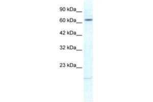 Western Blotting (WB) image for anti-Potassium Voltage-Gated Channel, Subfamily H (Eag-Related), Member 6 (KCNH6) antibody (ABIN2461136) (KCNH6 Antikörper)