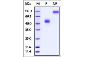 Rabbit TIGIT, Fc Tag on SDS-PAGE under reducing (R) and no-reducing (NR) conditions. (TIGIT Protein (AA 16-142) (Fc Tag))