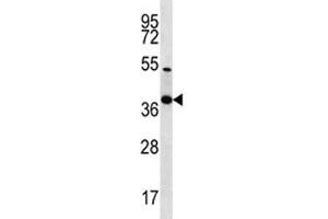 NKX2. (Nkx2-2 Antikörper  (AA 2-2))