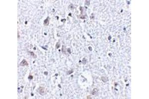 Immunohistochemistry of BRSK1 in human brain tissue with BRSK1 antibody at 2. (BRSK1 Antikörper  (C-Term))