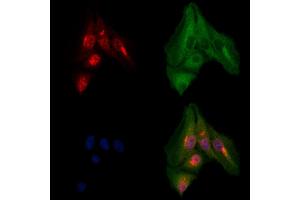 anti-Phosphoglycolate Phosphatase (PGP) (Internal Region) antibody