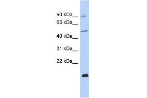 WB Suggested Anti-ZNF645 Antibody Titration:  0. (ZNF645 Antikörper  (Middle Region))