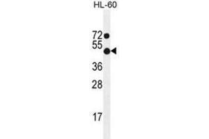 ADA Antibody (C-term) western blot analysis in HL-60 cell line lysates (35 µg/lane). (ADA Antikörper  (C-Term))
