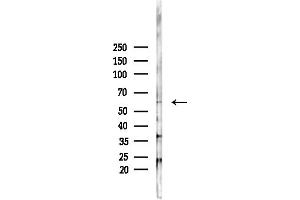 anti-SNF1A/AMP-Activated Protein Kinase (SNF1A) (pThr172) antibody