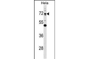 Western blot analysis in Hela cell line lysates (35ug/lane). (Epsin 1 Antikörper  (AA 203-232))