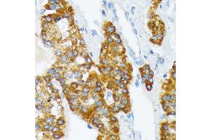 Immunohistochemistry (IHC) image for anti-ATPase, Na+/K+ Transporting, beta 3 Polypeptide (ATP1B3) antibody (ABIN7265774)