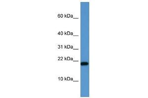 SH2D1A antibody (70R-10049) used at 0.