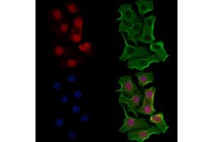 ABIN6257683 and ABIN6274587 staining Hela cells by IF/ICC. (Apoptosis Inhibitor 5 Antikörper  (C-Term))