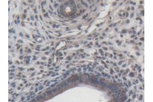 Detection of MMP9 in Rat Uterus Tissue using Monoclonal Antibody to Matrix Metalloproteinase 9 (MMP9)