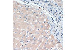 Immunohistochemistry of paraffin-embedded human liver using DBH antibody (ABIN6130337, ABIN6139418, ABIN6139419 and ABIN6218164) at dilution of 1:200 (40x lens). (DBH Antikörper  (AA 388-617))