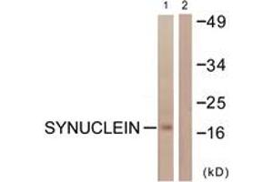 Western blot analysis of extracts from HuvEc cells, using Synuclein (Ab-129) Antibody. (Synuclein Antikörper  (AA 91-140))