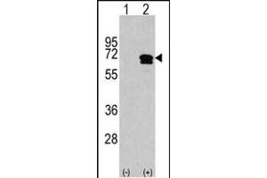 Western blot analysis of CKK2 (arrow) using rabbit polyclonal CKK2 Antibody (C-term) (ABIN1882069 and ABIN2841278). (CAMKK2 Antikörper  (C-Term))