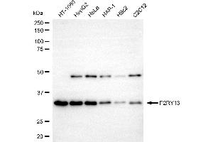 anti-Purinergic Receptor P2Y, G-Protein Coupled, 13 (P2RY13) antibody