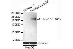 Western blot analysis of extracts of HepG2 cells, using Phospho-PDGFRA-Y849 antibody. (PDGFRA Antikörper  (pTyr849))