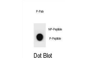 Dot blot analysis of CCNB2 Antibody (Phospho ) Phospho-specific Pab (ABIN1881158 and ABIN2839950) on nitrocellulose membrane.