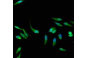 Immunofluorescence staining of Hela cells with ABIN7154629 at 1:133, counter-stained with DAPI. (K-RAS Antikörper  (AA 2-168))