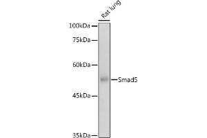 Western blot analysis of extracts of Rat lung, using Smad5 antibody (ABIN1682808, ABIN5663732, ABIN5663734 and ABIN6213914) at 1:500 dilution. (SMAD5 Antikörper  (AA 140-240))
