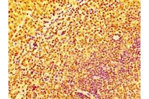 Immunohistochemistry (IHC) image for anti-Interferon gamma Receptor 2 (Interferon gamma Transducer 1) (IFNGR2) (AA 28-205) antibody (ABIN7156602)