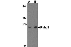 Image no. 1 for anti-Mex-3 Homolog D (MEX3D) (Internal Region) antibody (ABIN341677)