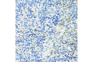 Immunohistochemistry of paraffin-embedded mouse spleen using TIM-3/H antibody (ABIN3016172, ABIN3016173, ABIN3016174, ABIN1680159 and ABIN6219599) at dilution of 1:100 (40x lens). (TIM3 Antikörper  (AA 22-202))