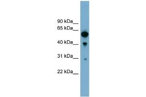 WB Suggested Anti-ARHGAP15 Antibody Titration: 0. (ARHGAP15 Antikörper  (Middle Region))