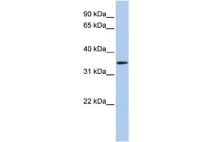 WB Suggested Anti-HADH Antibody Titration: 0.