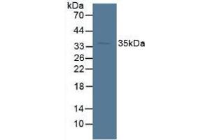 Figure. (SORD Antikörper  (AA 98-355))