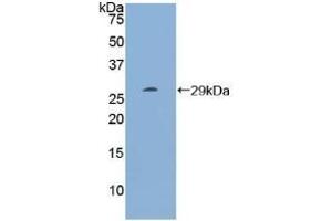 Detection of Recombinant RI, Human using Polyclonal Antibody to Ribonuclease Inhibitor (RI) (RNH1 Antikörper  (AA 218-444))