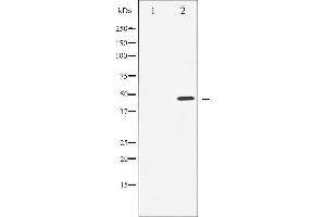 Western blot analysis of Cyclin E1 expression in Paclitaxel treated HeLa whole cell lysates,The lane on the left is treated with the antigen-specific peptide. (Cyclin E1 Antikörper  (C-Term))